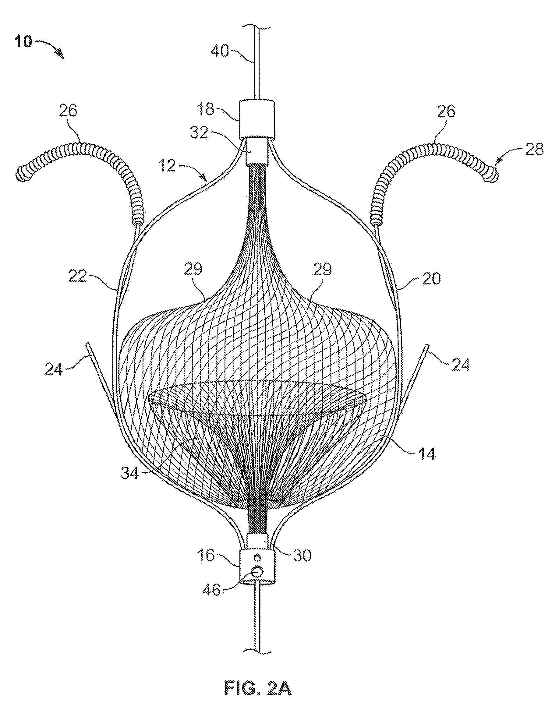 Mechanical tissue device and method