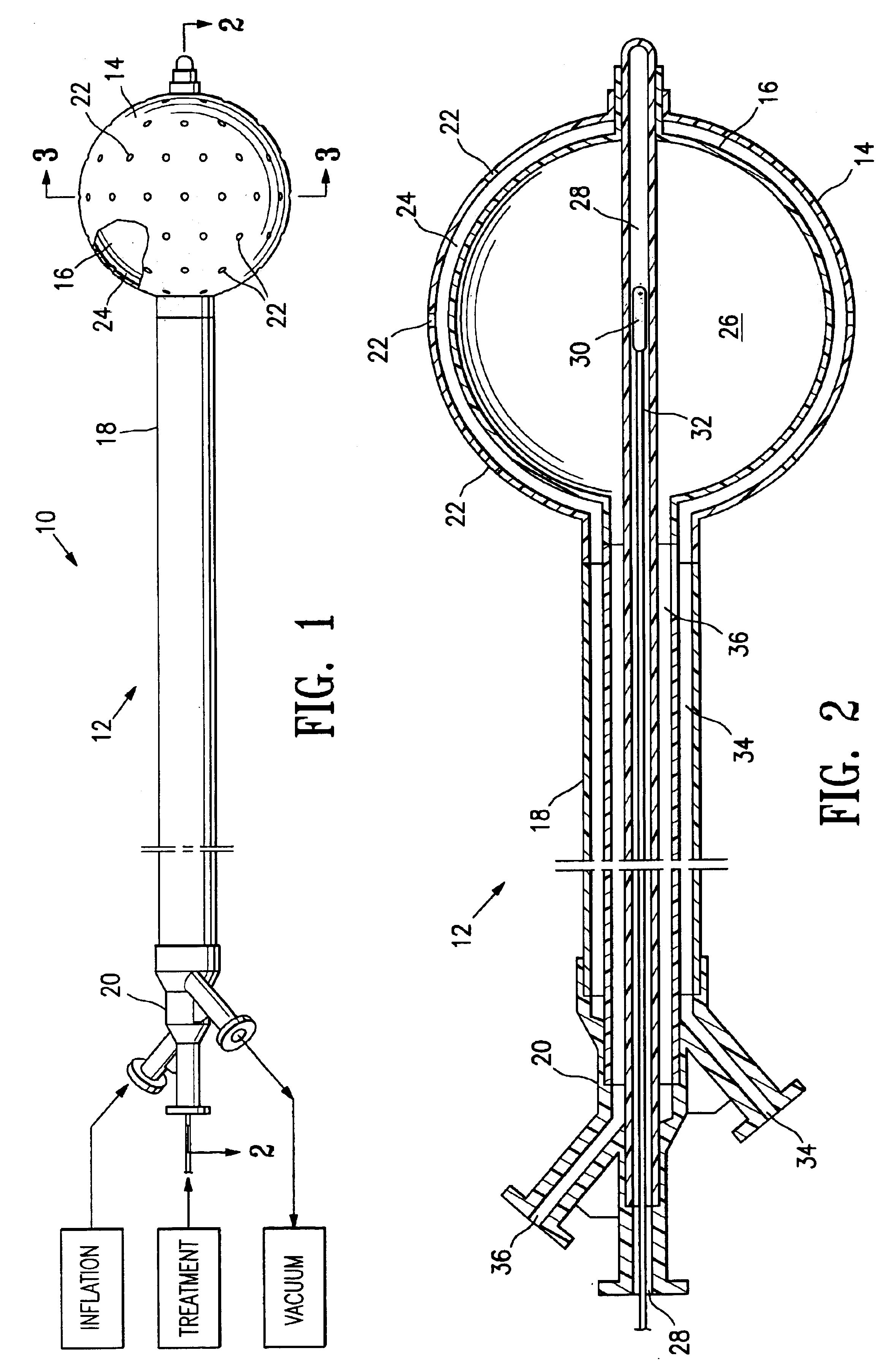 Vacuum device and method for treating tissue adjacent a body cavity