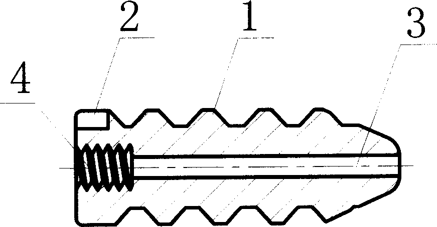 Biological extrusion screw and method for making same