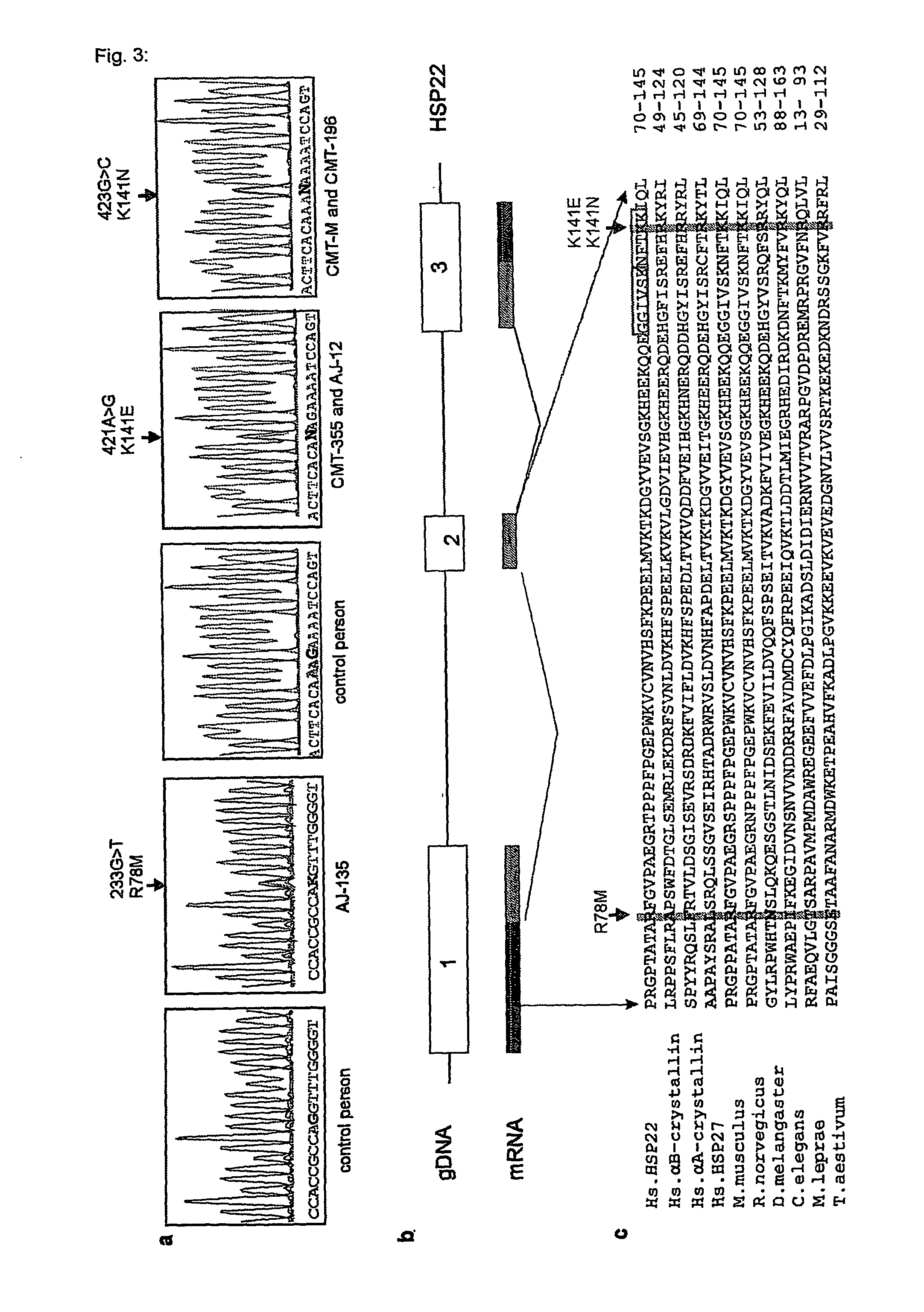 Diagnostic tests for the detection of motor neuropathy