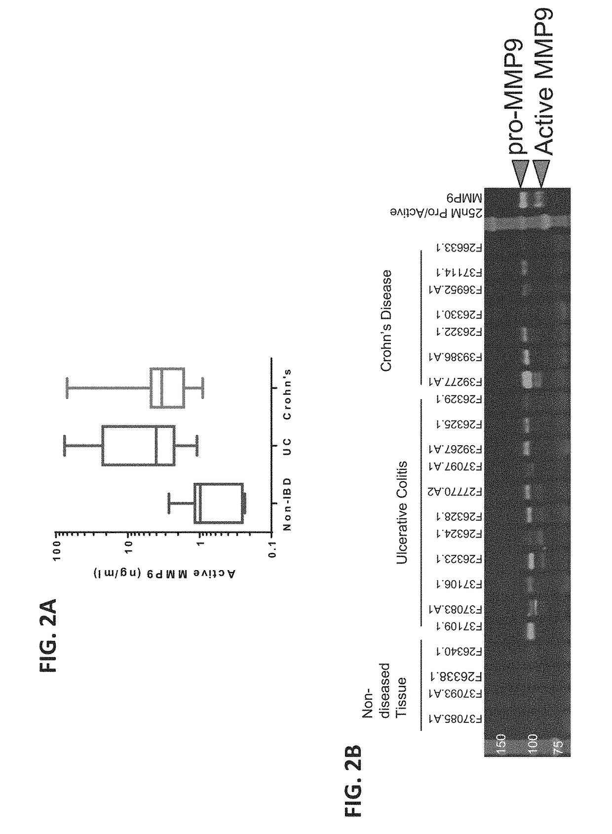 Compositions and methods for treating cancer, inflammatory diseases and autoimmune diseases
