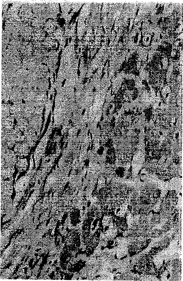 TPA gene thread and its preparation method