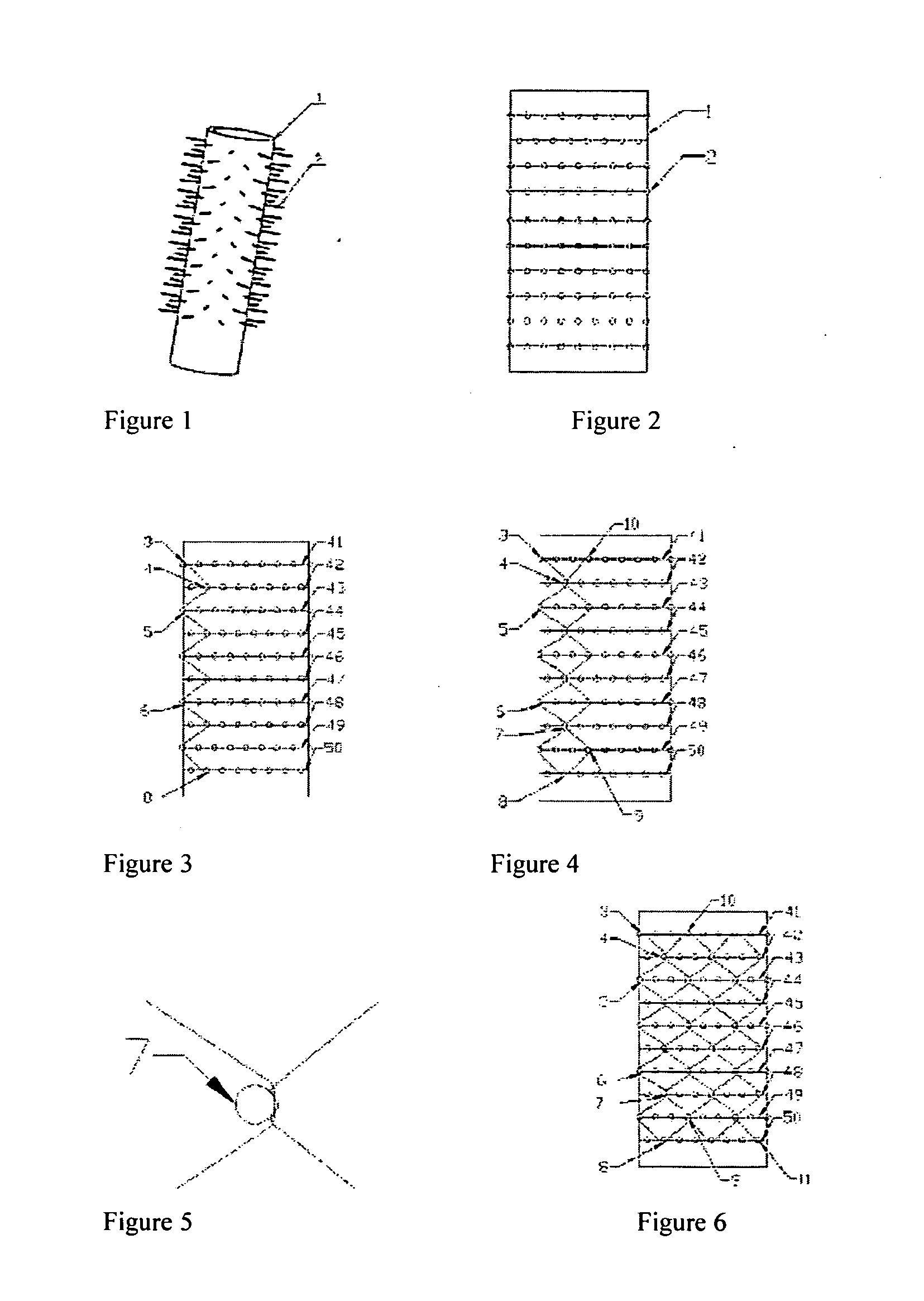 Braided Self-Expanding Endoluminal Stent and Manufacturing Method Thereof