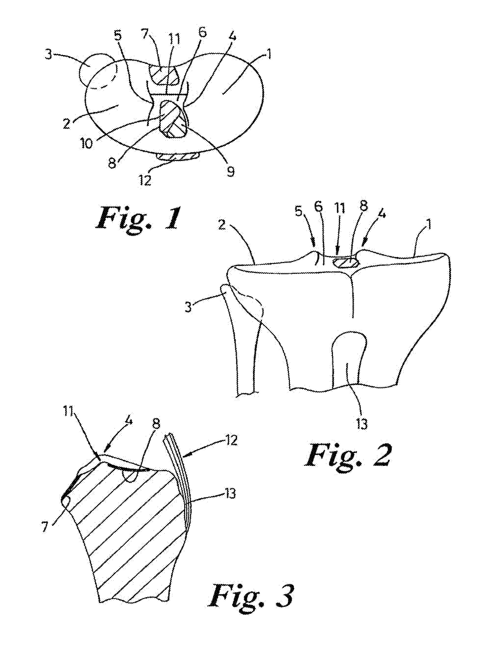 Reconstruction of Anterior Cruciate Ligaments