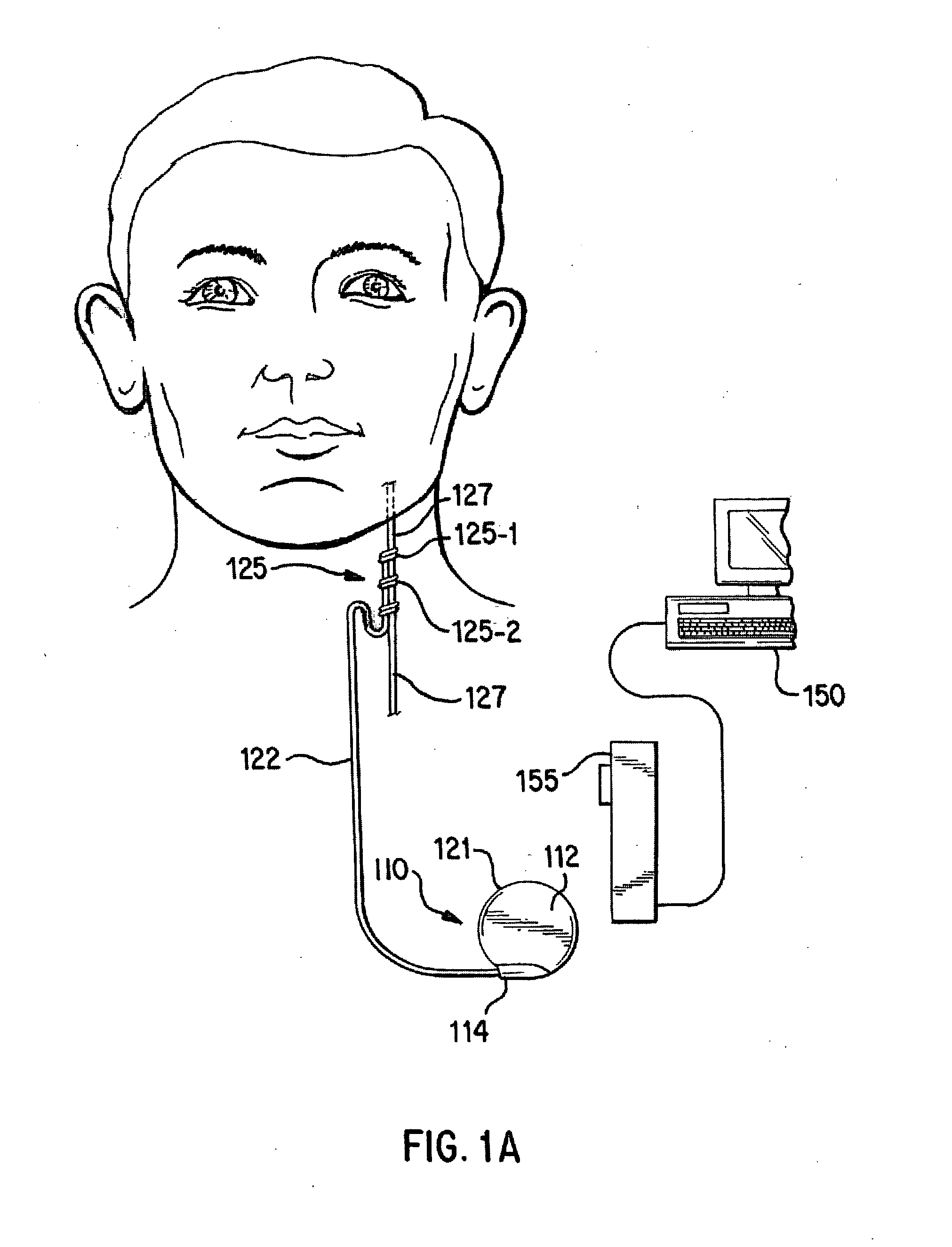 Impedance measurement for an implantable device