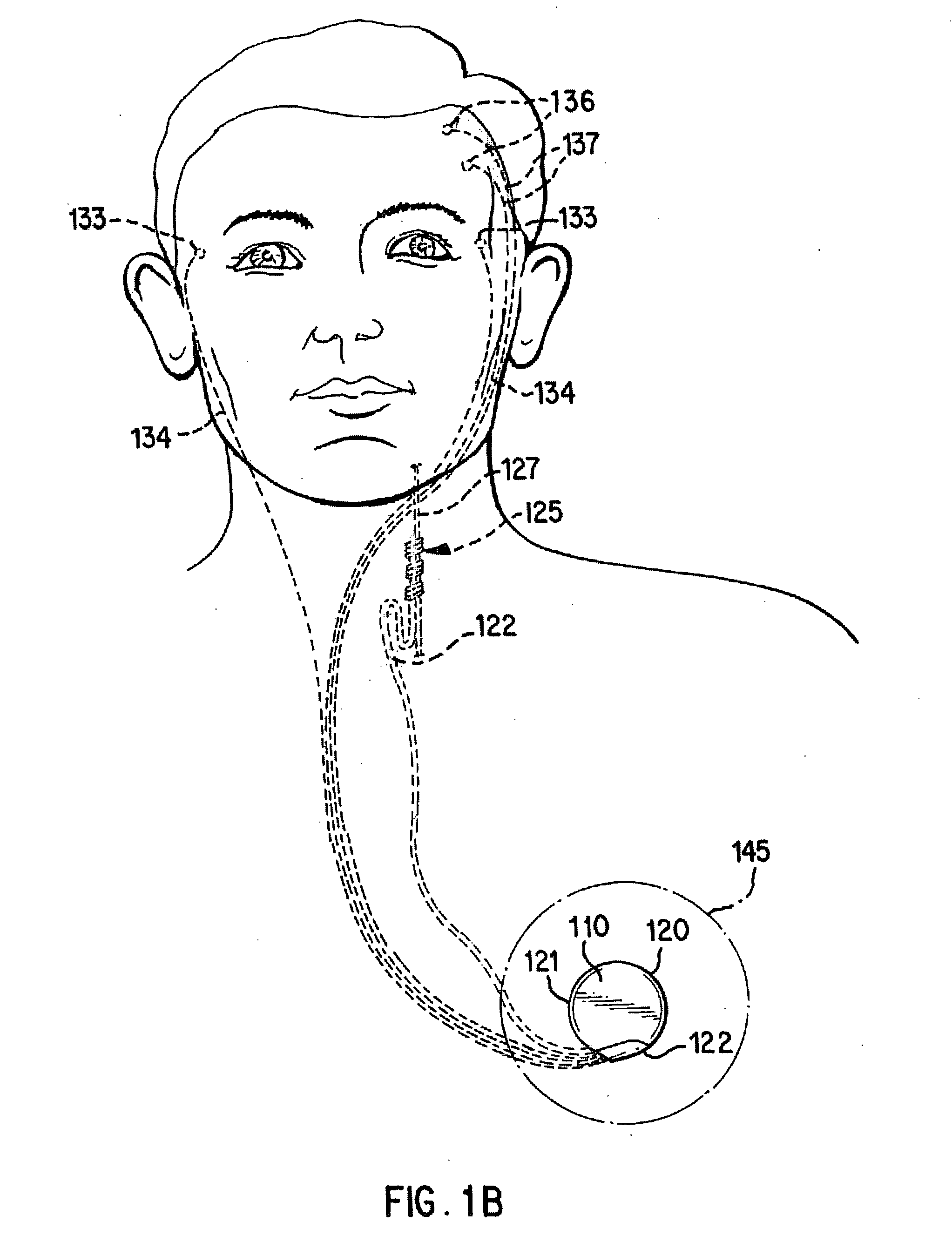 Impedance measurement for an implantable device