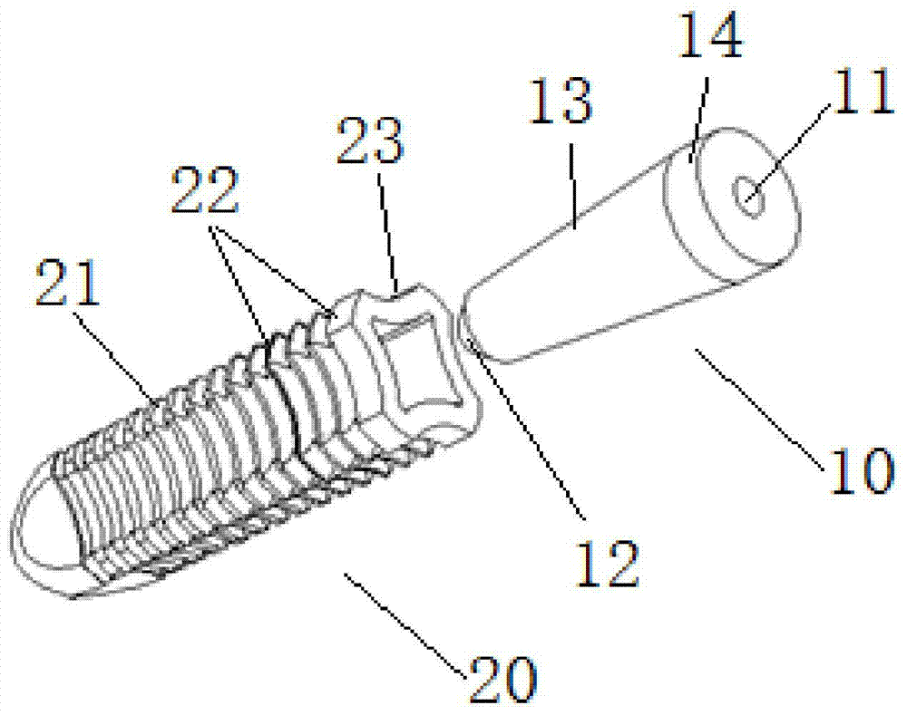 Fixation device, fixation method and method of use for cruciate ligament reconstruction