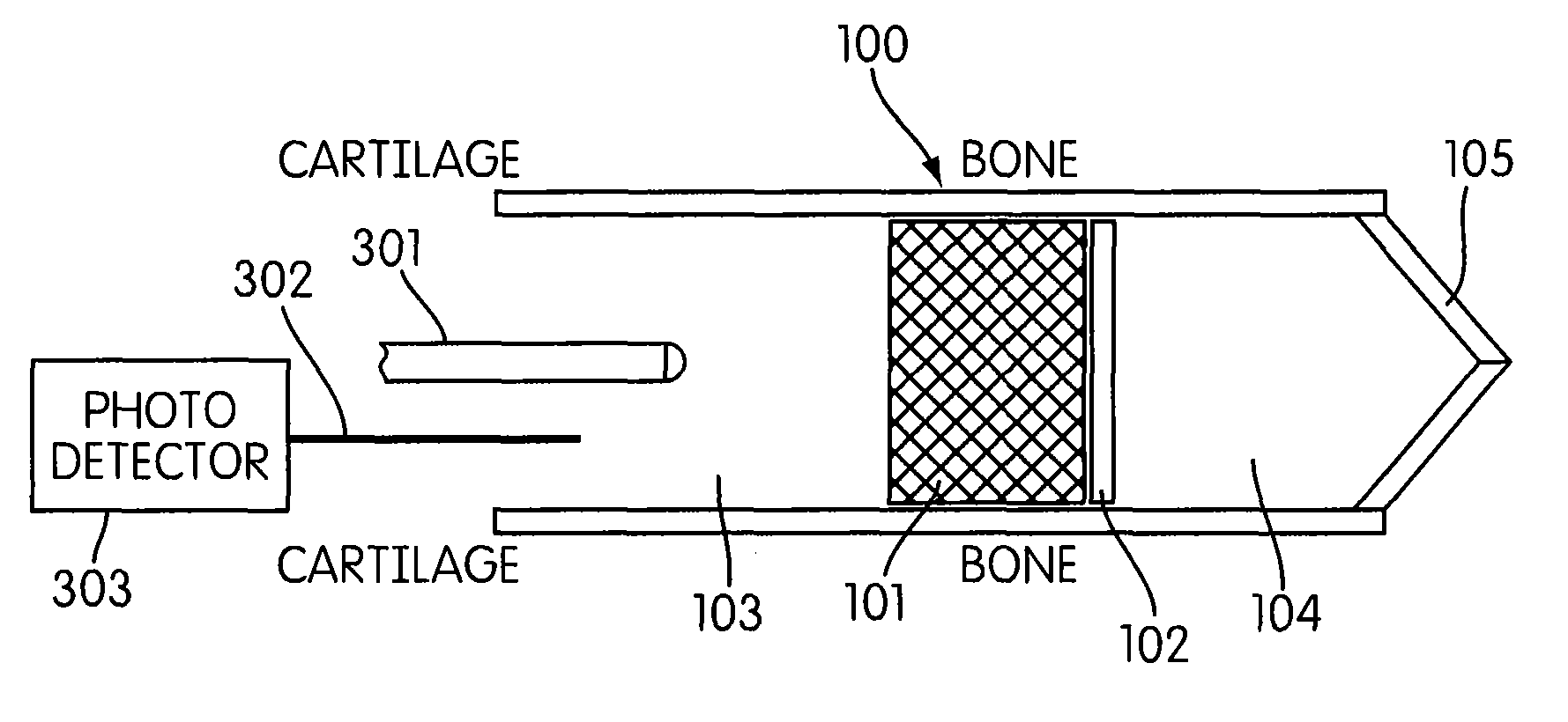Earpiece and method for forming an earpiece