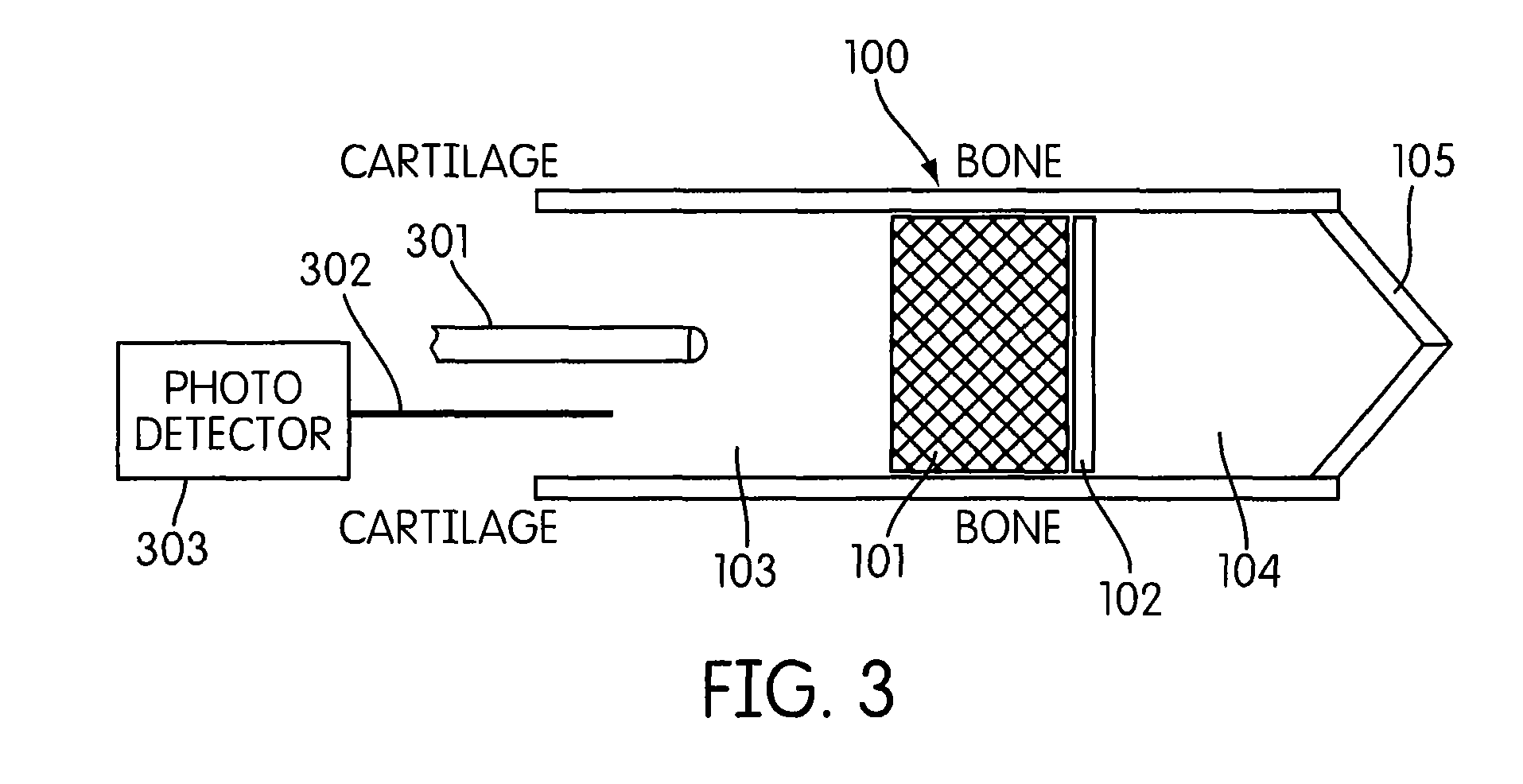 Earpiece and method for forming an earpiece