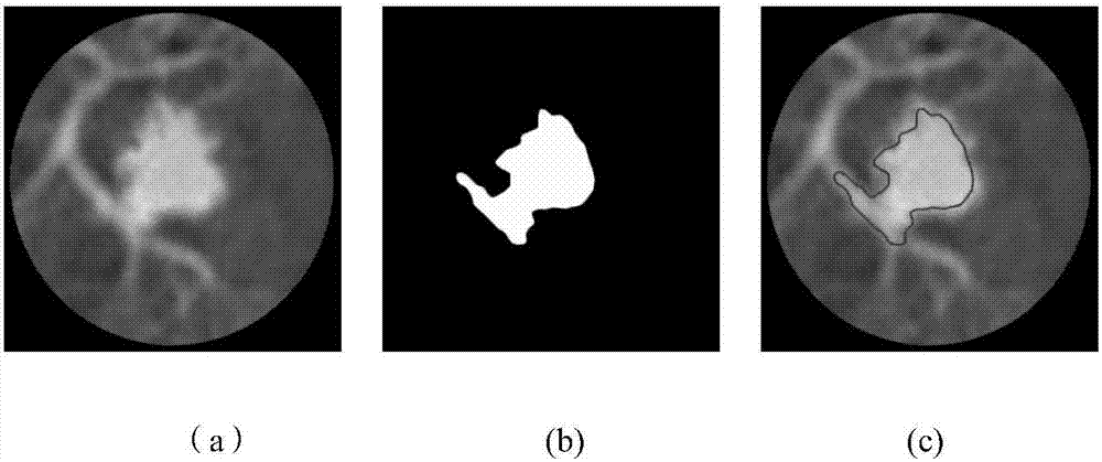 Pulmonary nodule segmentation method of LBF active contour model based on information entropy and combination vector
