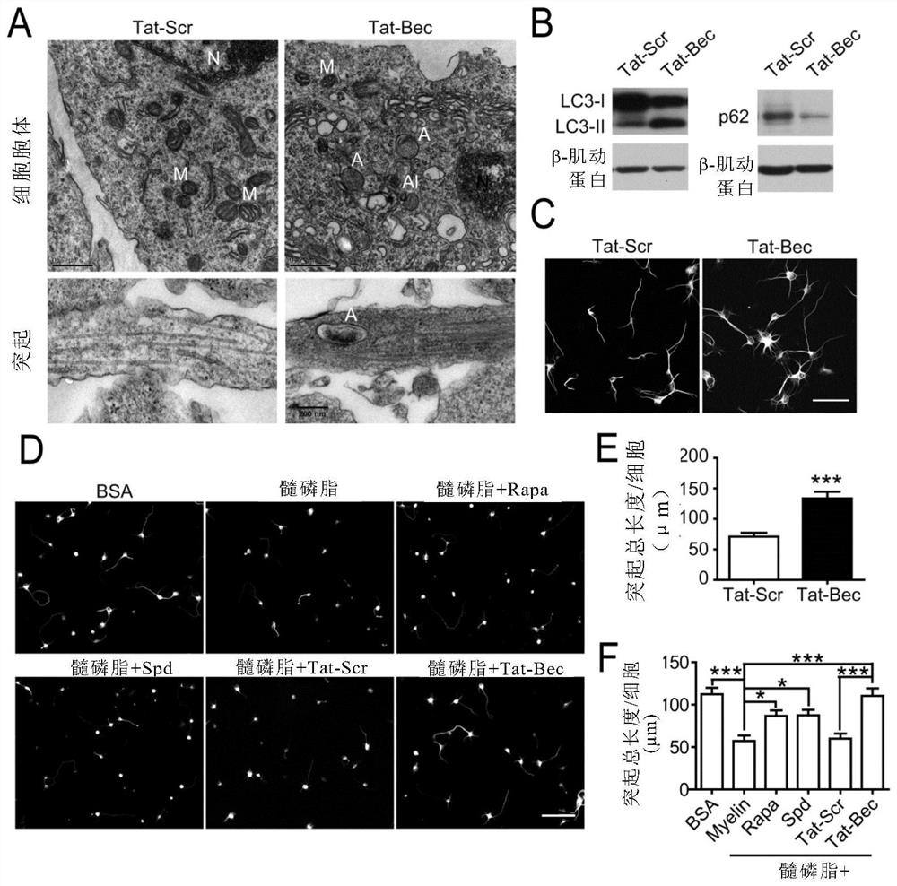 Use of autophagy inducers as microtubule stabilizing drugs to promote nerve regeneration