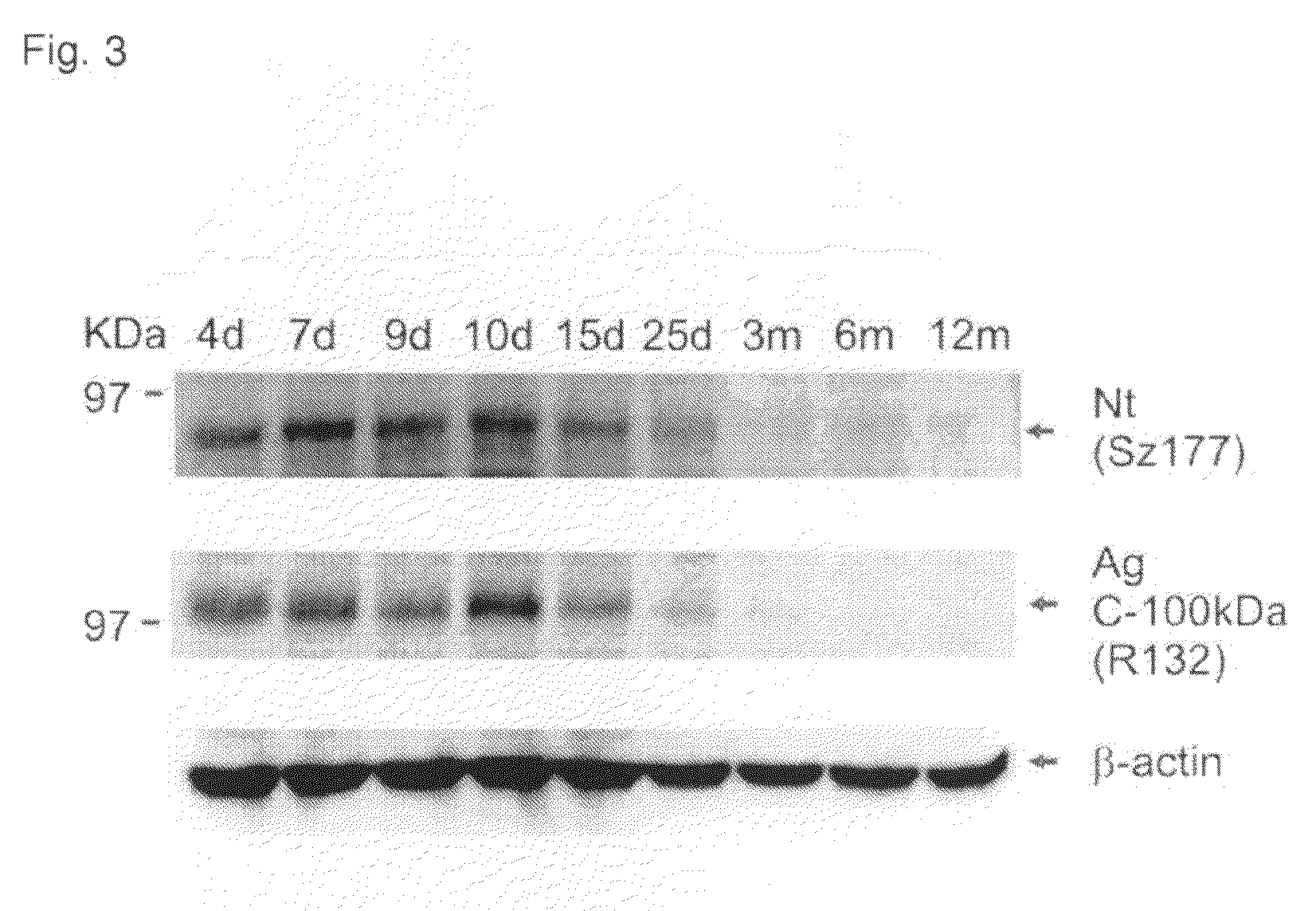 Method for determining inhibitors of neurotrypsin