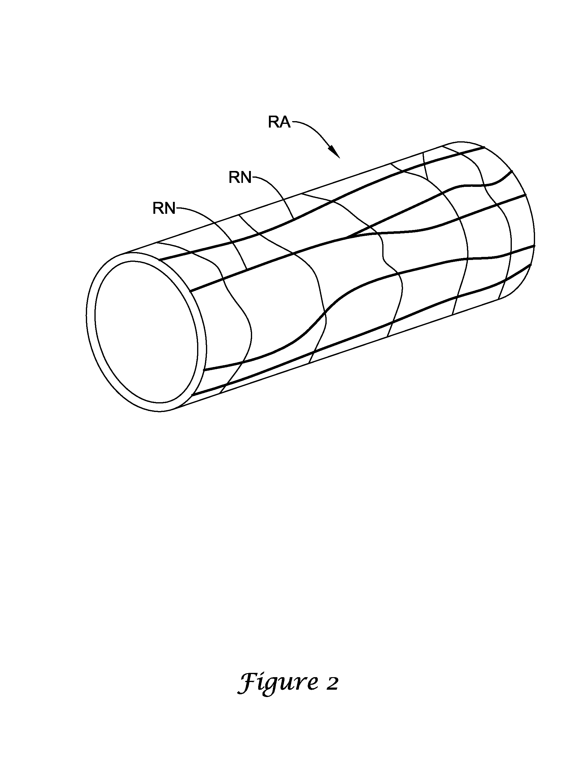 Catheter having rib and spine structure supporting multiple electrodes for renal nerve ablation