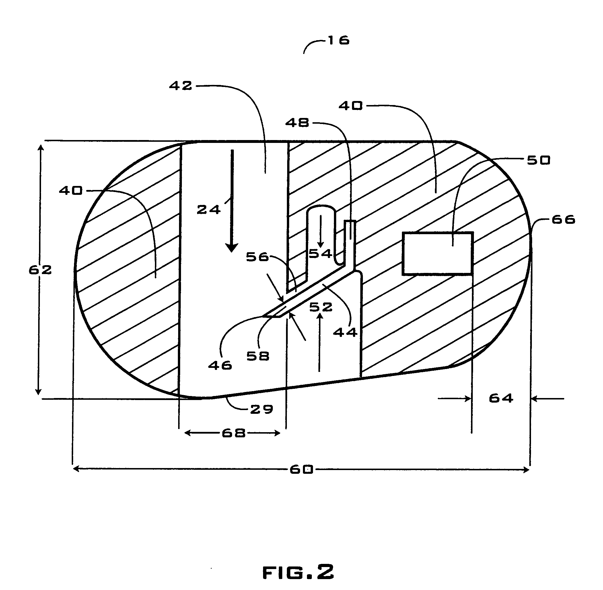 Apparatus for moving a misplaced or impacted tooth