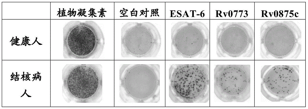 Tuberculosis immunodiagnostic molecular marker and its vaccine application