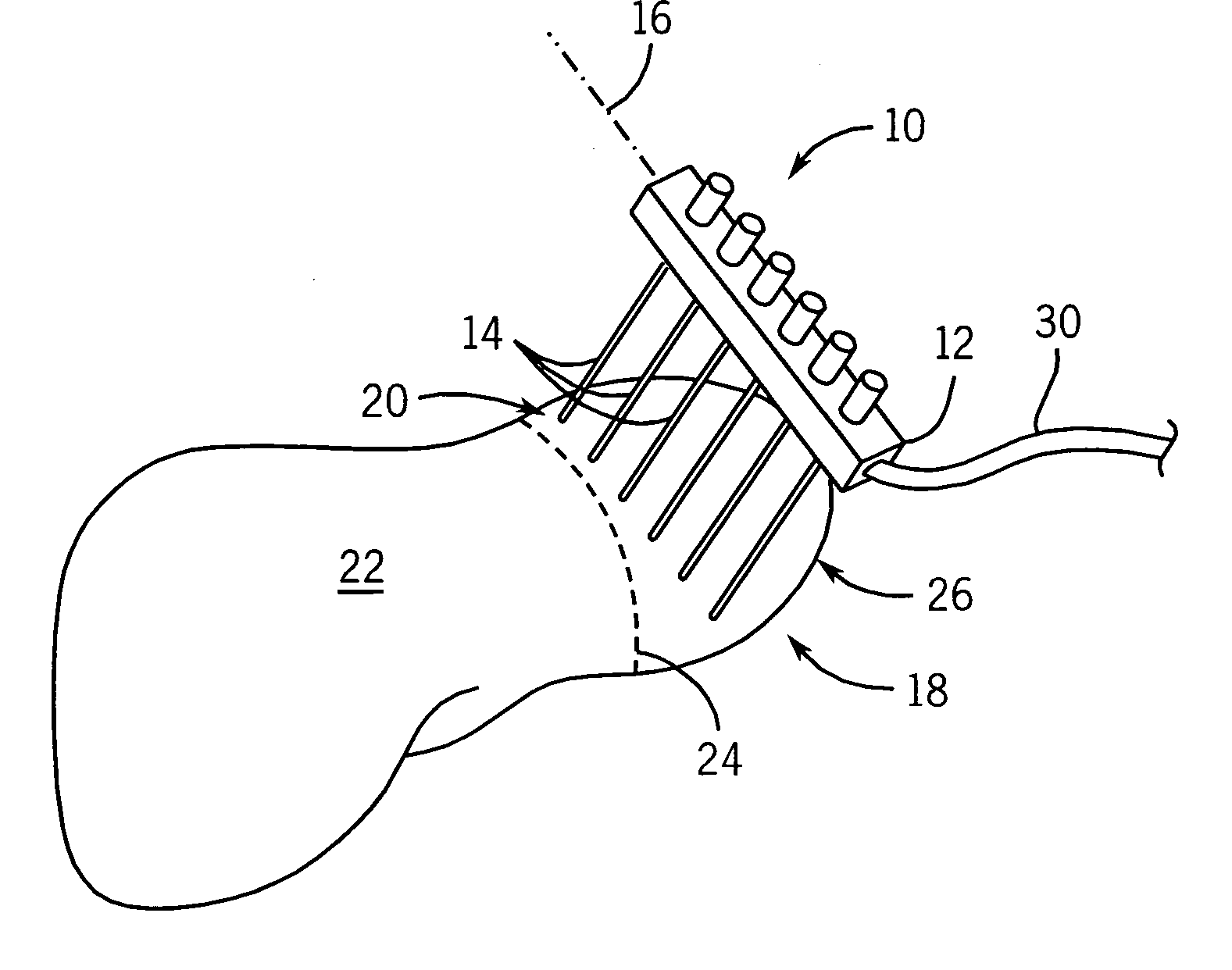 Electrode array for tissue ablation