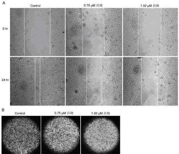 Novel multifunctional podophyllotoxin derivate as well as preparation method and application thereof