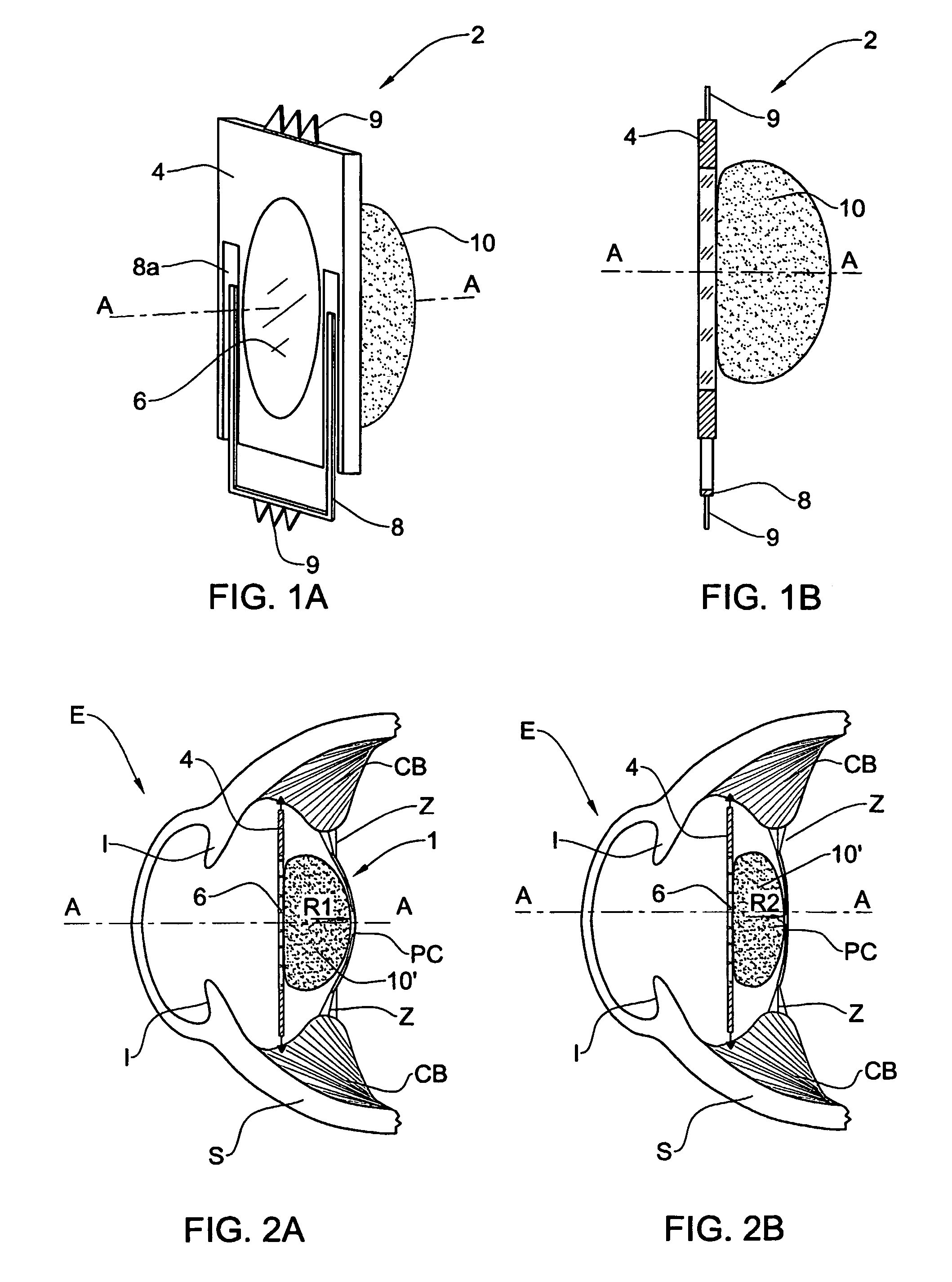 Accommodating lens assembly