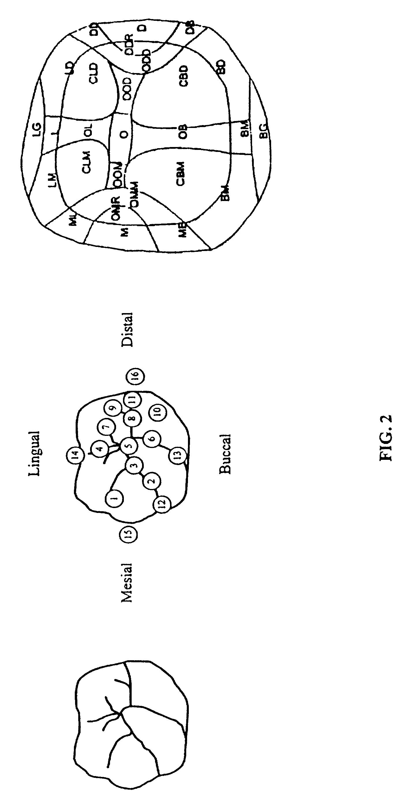 Method and system for recording carious lesions