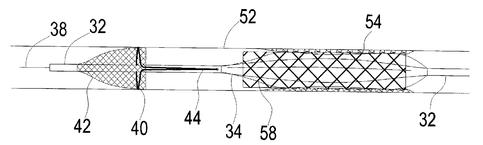 Device for angioplasty with an embolization protection component and method therefor