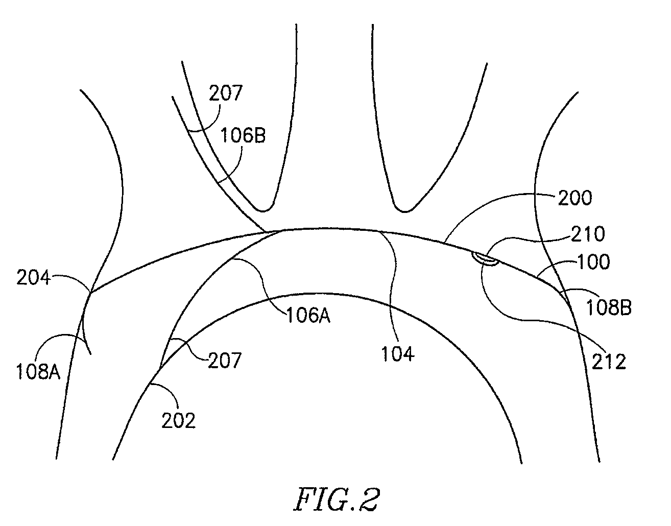 Device and method for vascular filter