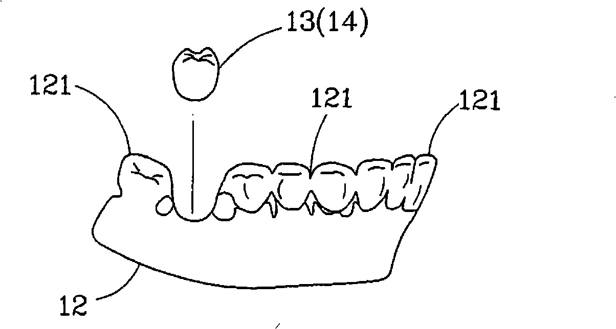 Method for produce digital tooth implantation planning auxiliary assembly
