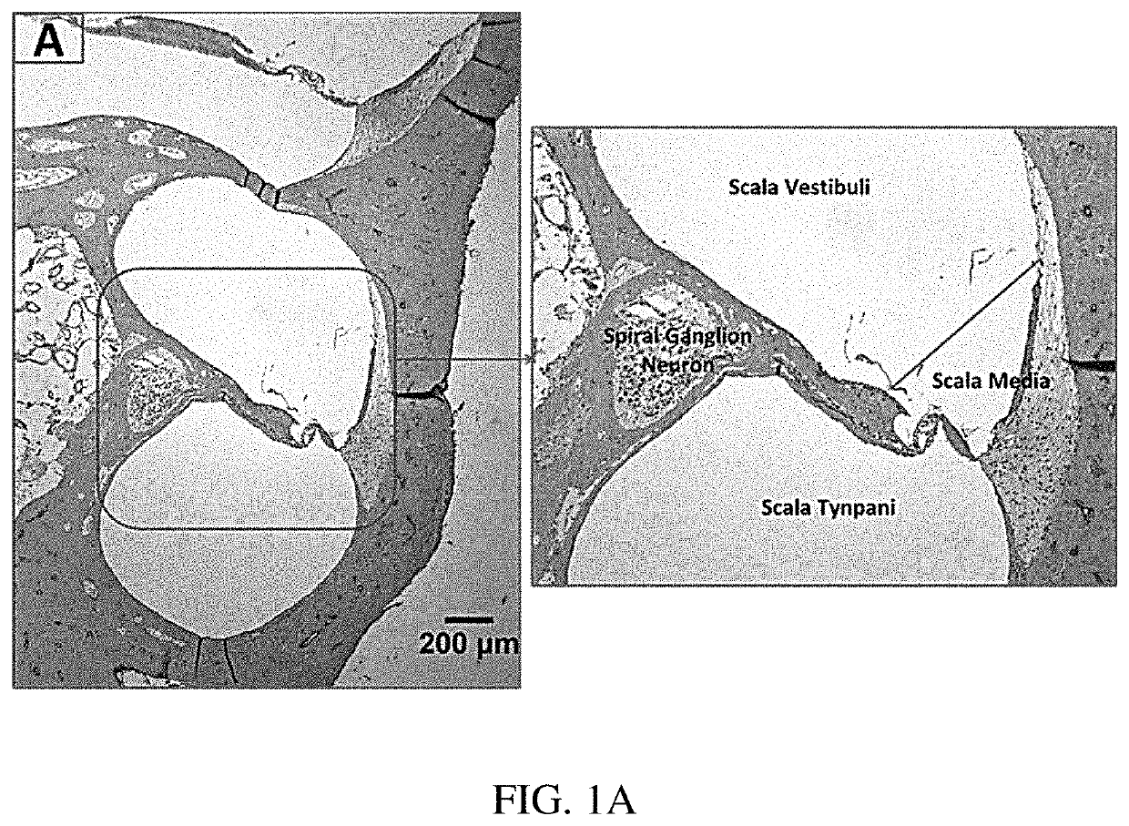 Uses of glucagon-like peptide-1 receptor agonists for treating trauma-induced hearing loss