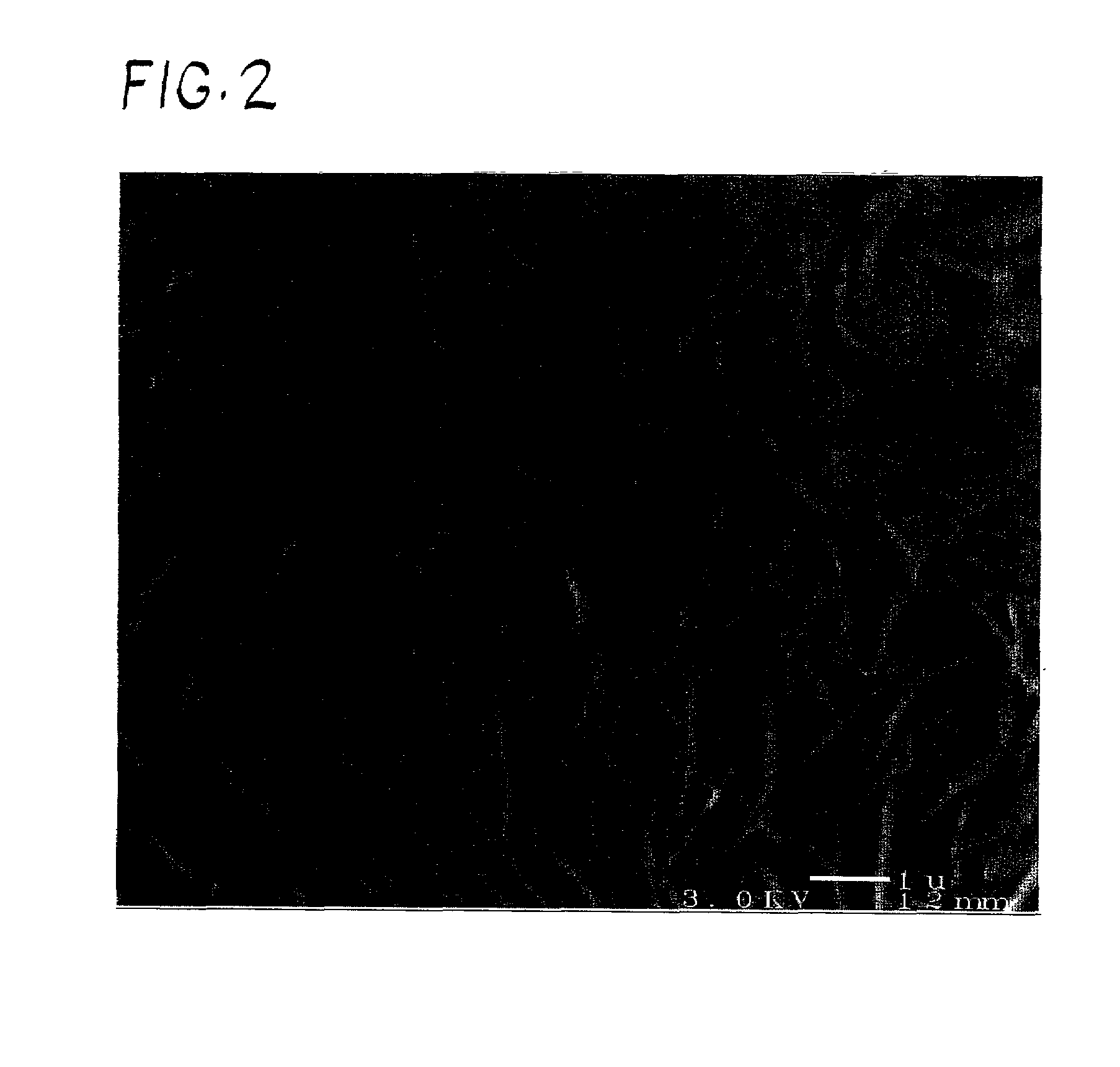 Electrolytic deposition of coatings for prosthetic metals and alloys