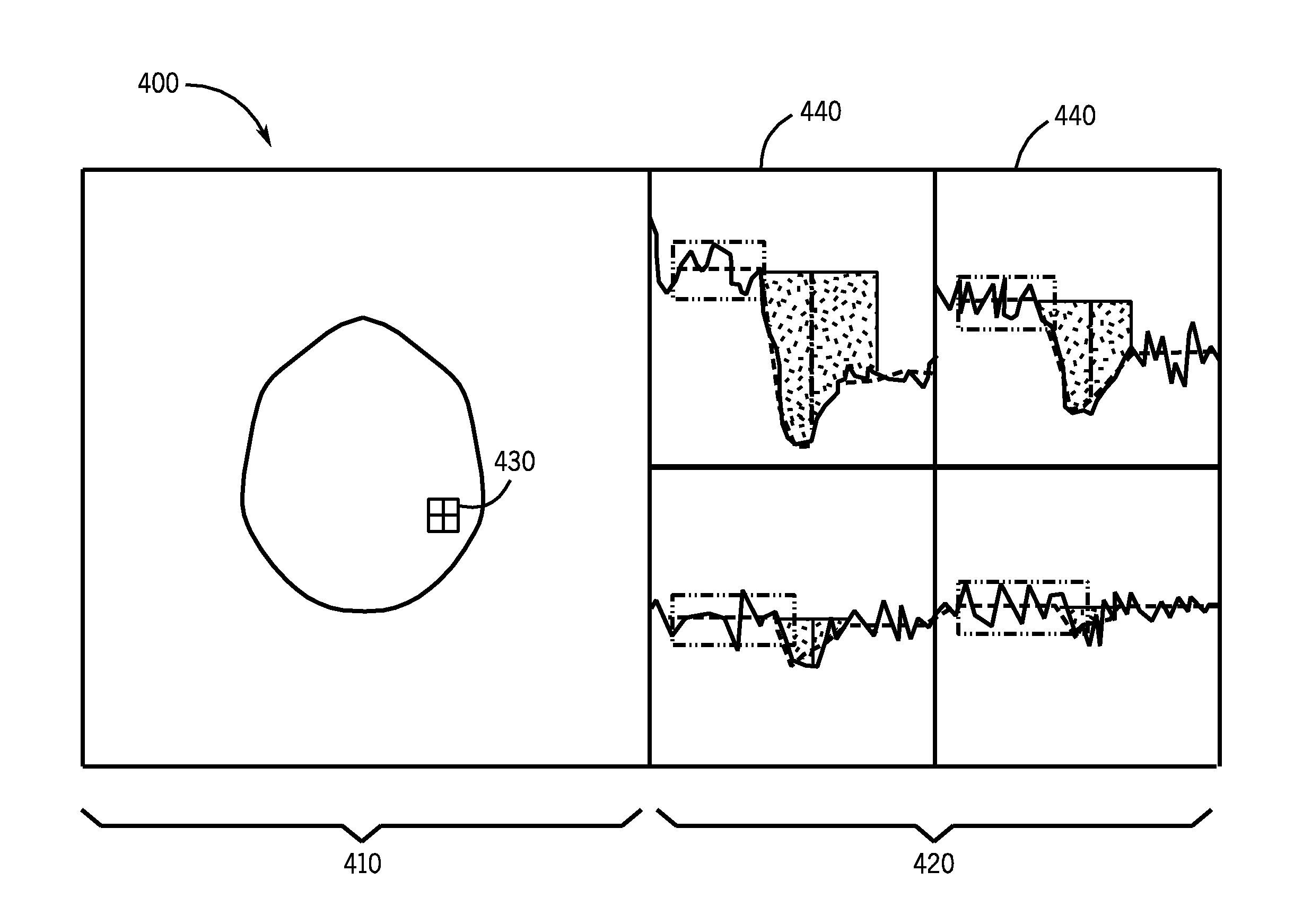 Method, apparatus and user interface for determining an arterial input function used for calculating hemodynamic parameters