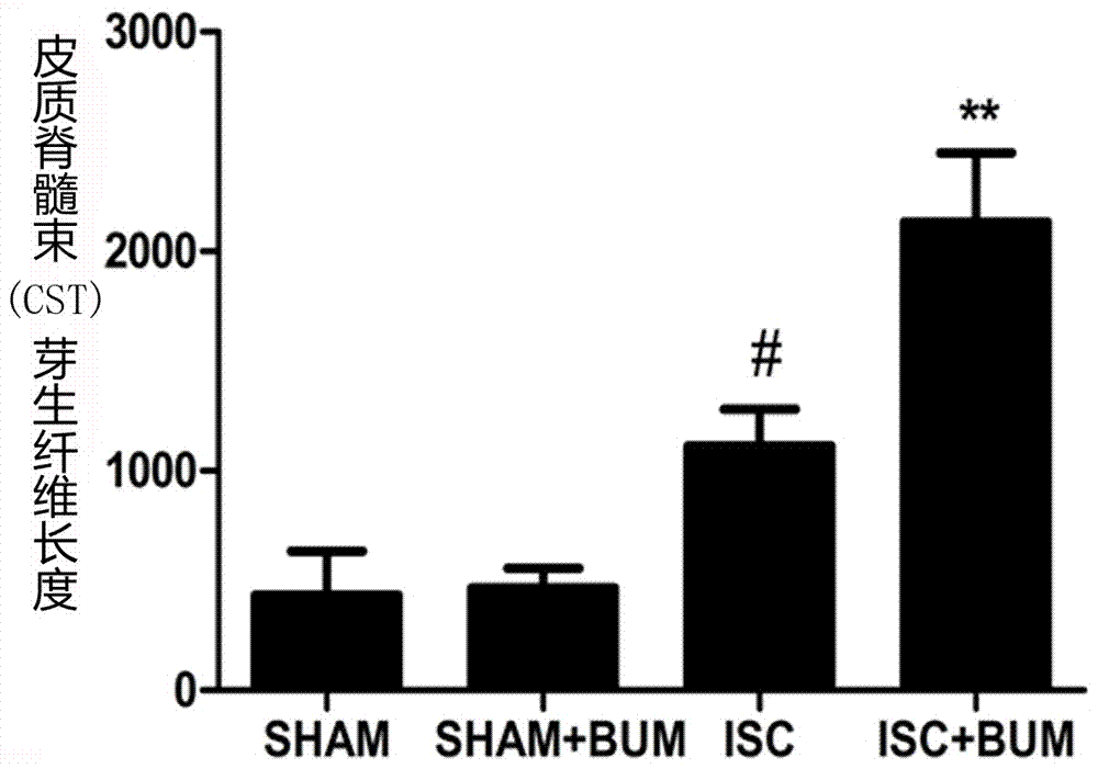 Application of bumetanide in promoting neural functional reconstruction in recovery period after ischemic stroke