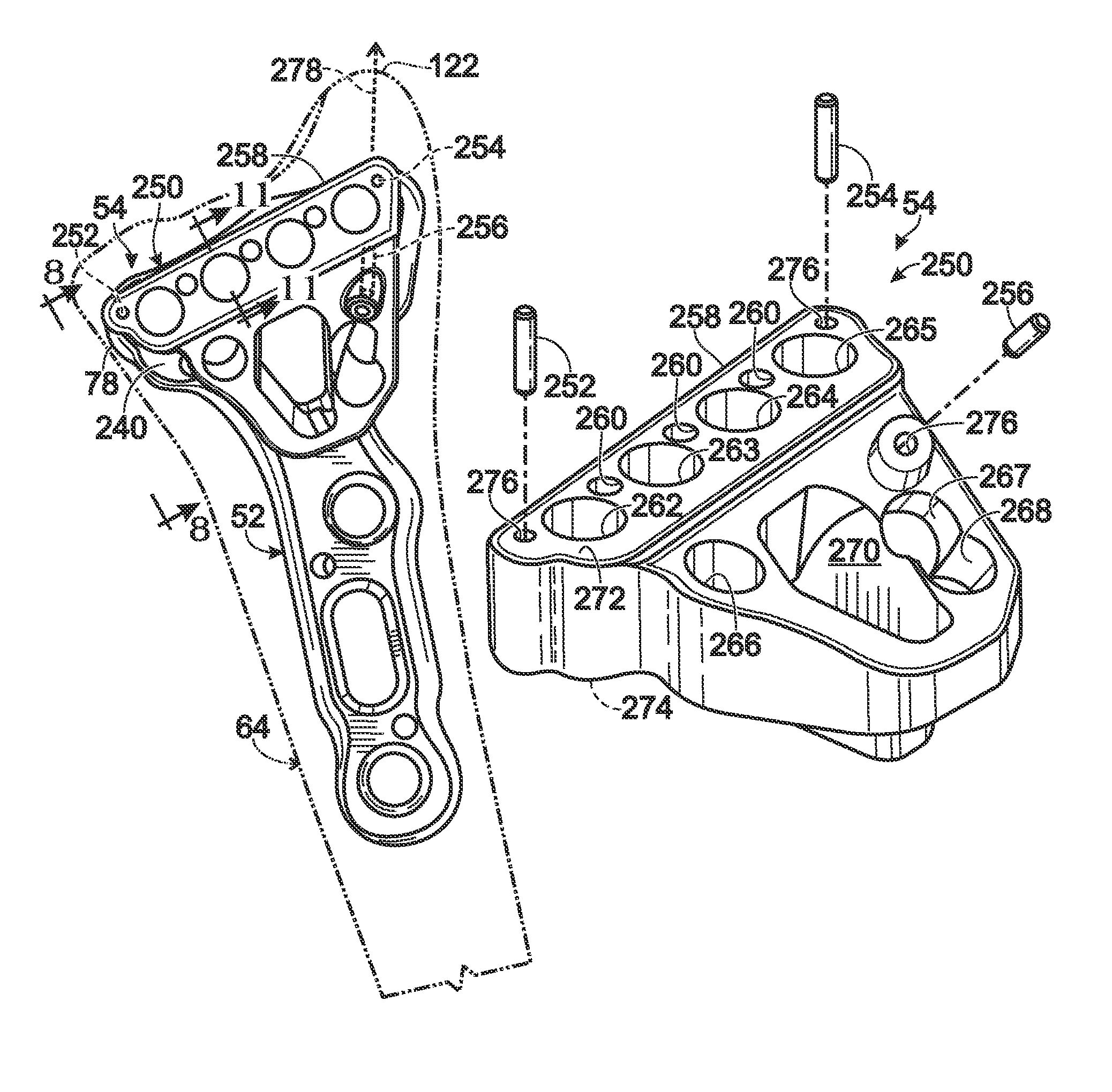 Targeting guide with a radiopaque marker to facilitate positioning a bone plate on bone