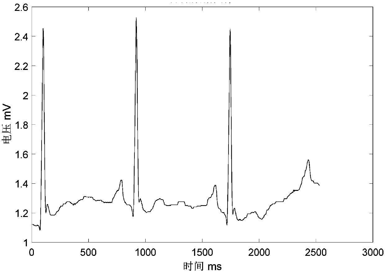 ECG signal feature extraction method, device, equipment and system and storage medium