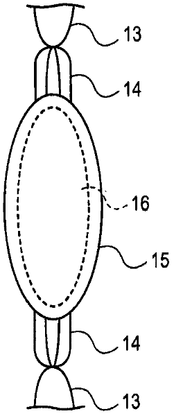Intraocular lens and method of compensating for changes in capsule size and changes in the eye after implantation