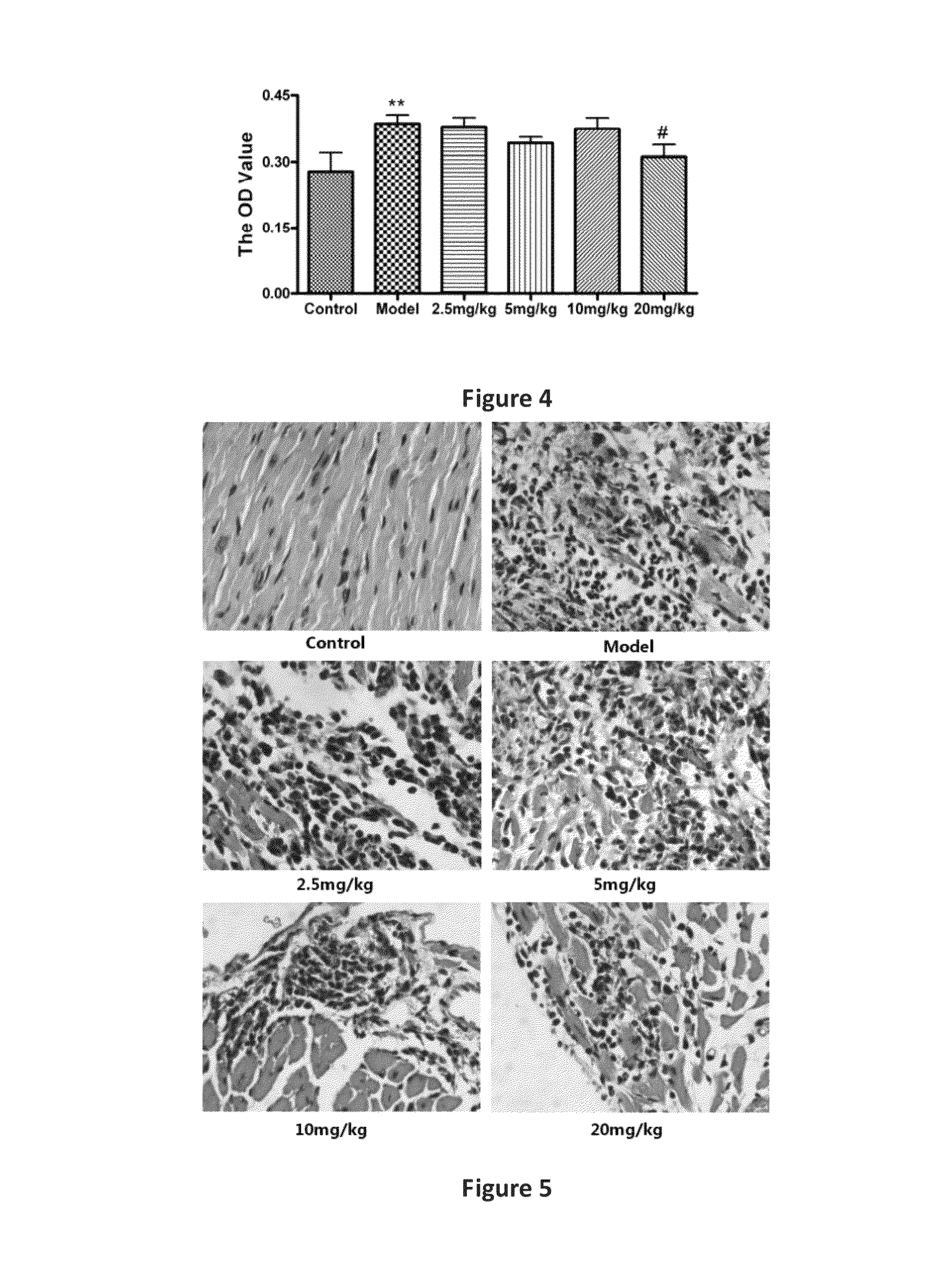 Line leaf inula flower lactone A and methods for preparing and using the same for treating myocarditis