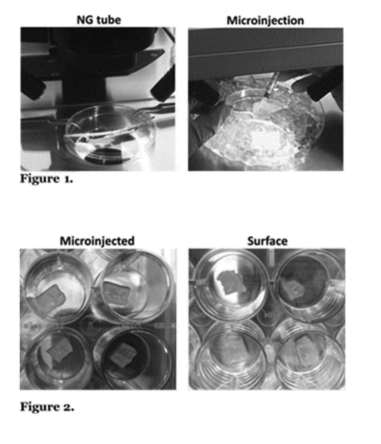 Tissue engineering