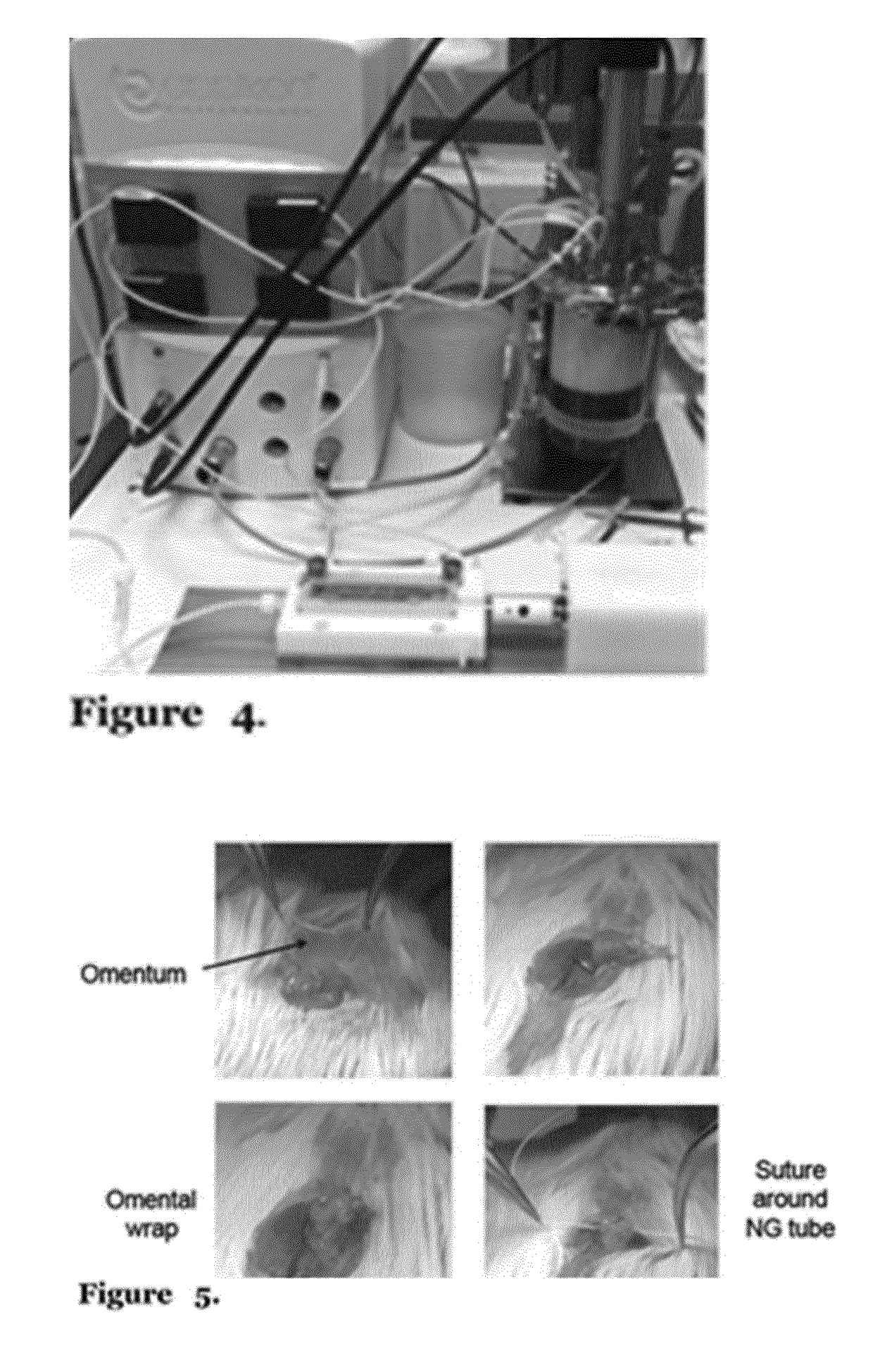 Tissue engineering