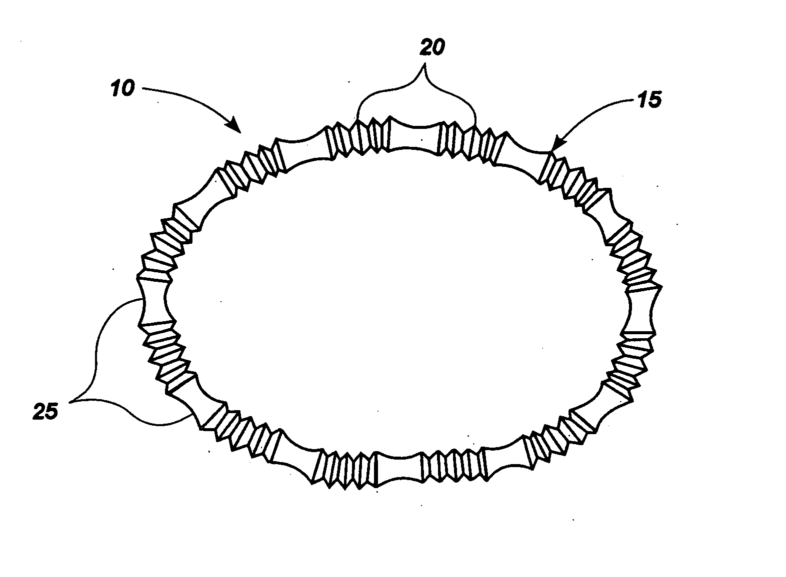 Methods and apparatus for controlling the internal circumference of an anatomic orifice or lumen