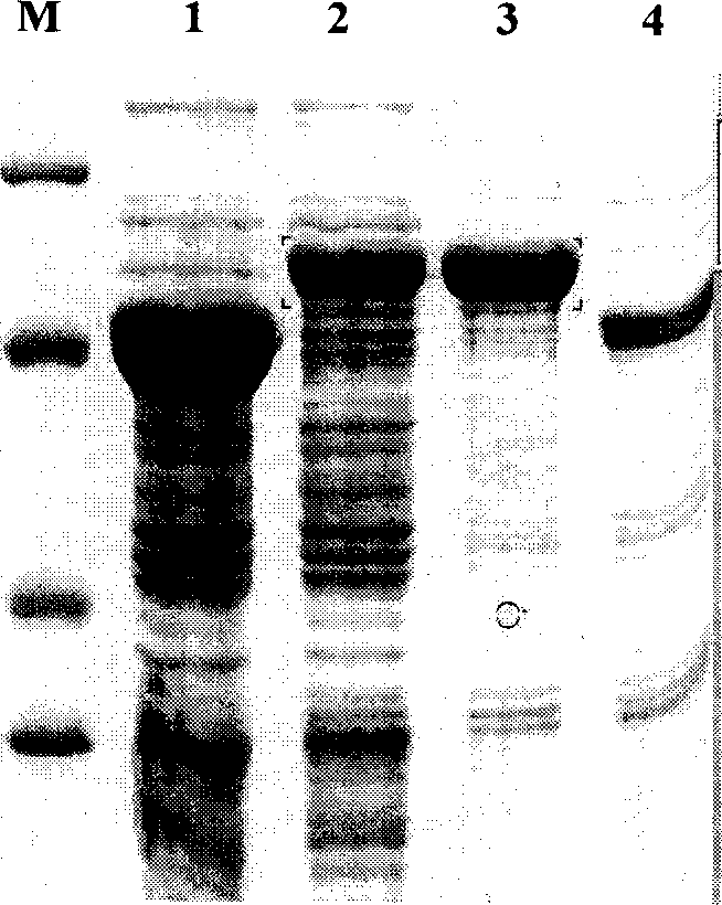 Recombination human endothelium chalene expression strain and solubility expression method