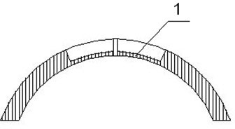 Rectal injury discriminator