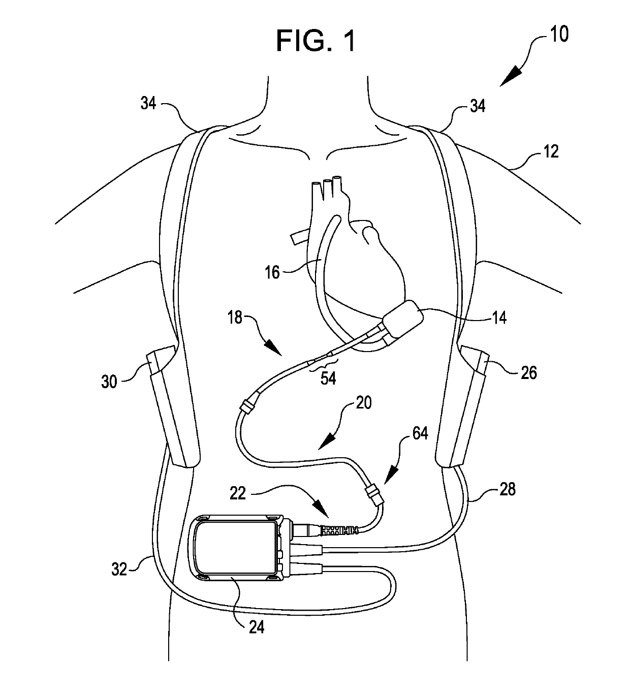 Modular Flying Lead Cable and Methods for Use With Heart Pump Controllers