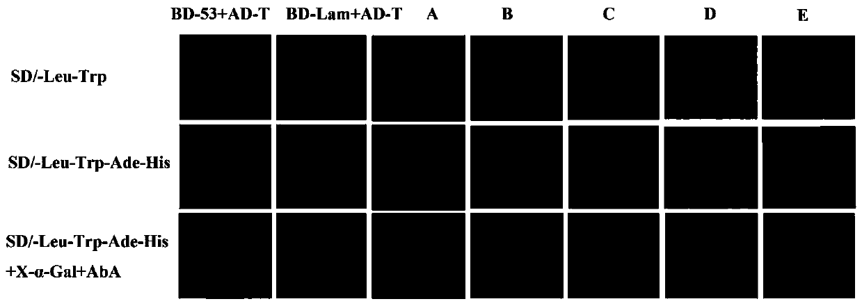 Peach fruit acid invertase inhibitor gene PpINH1, and encoded protein, cloning method and application thereof