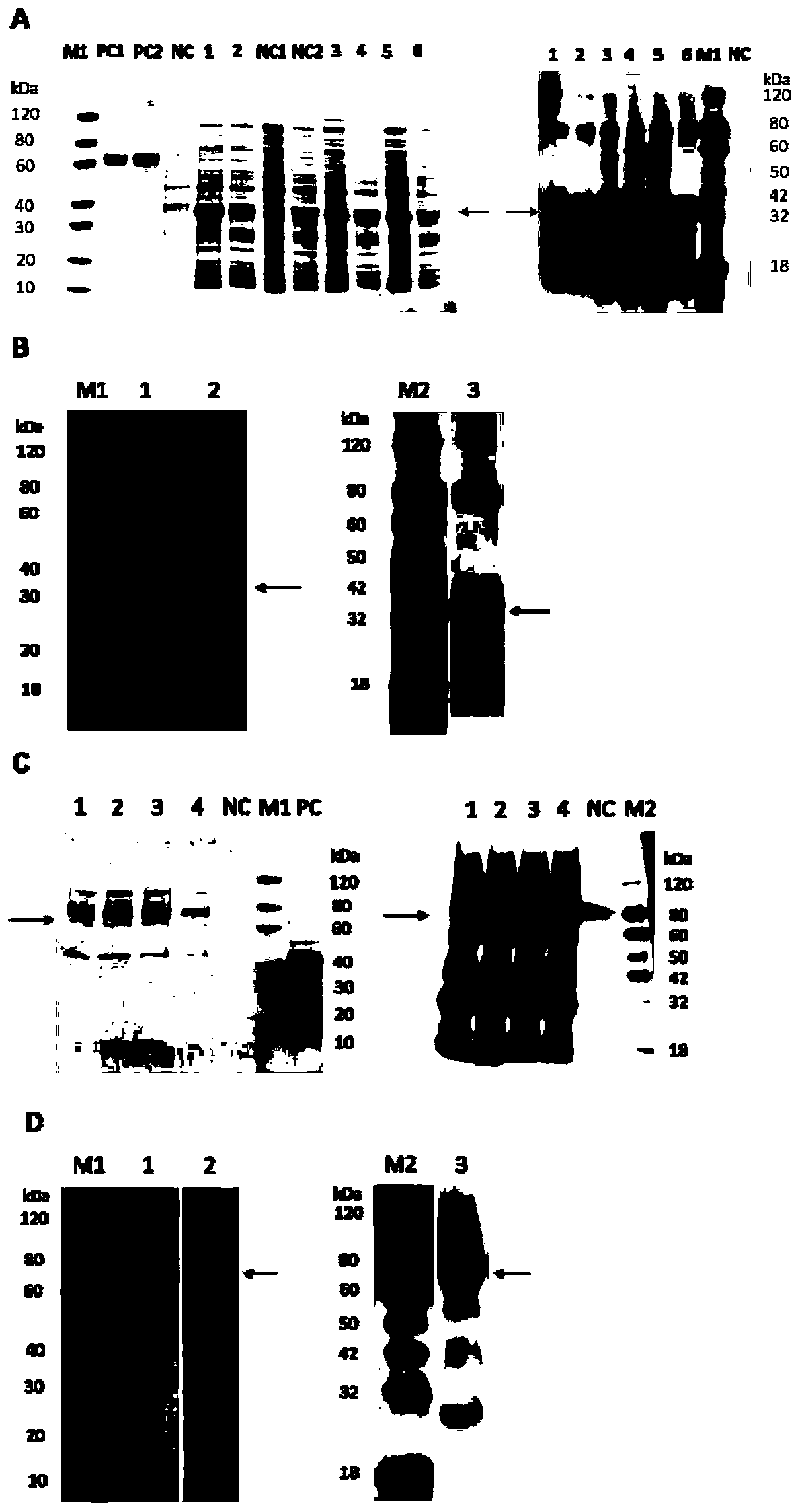 Peach fruit acid invertase inhibitor gene PpINH1, and encoded protein, cloning method and application thereof