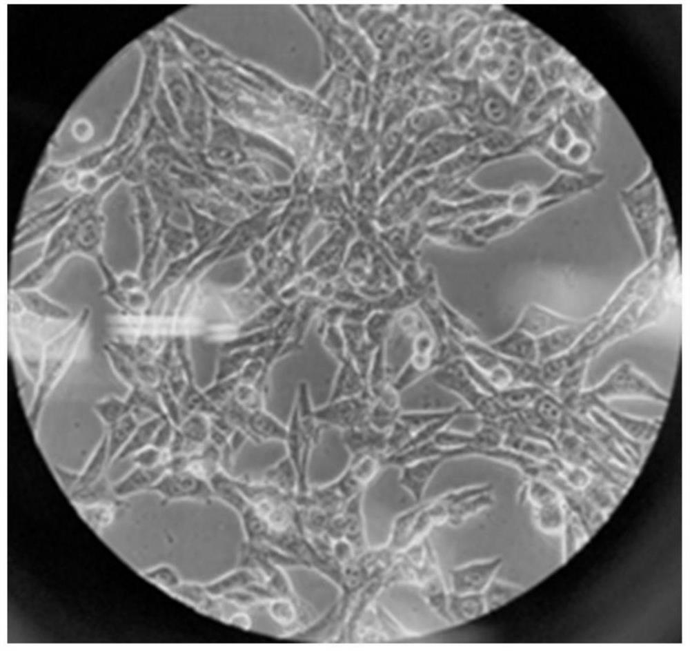 Application of attenuated salmonella in preparation of medicine for treating lung cancer pleural effusion