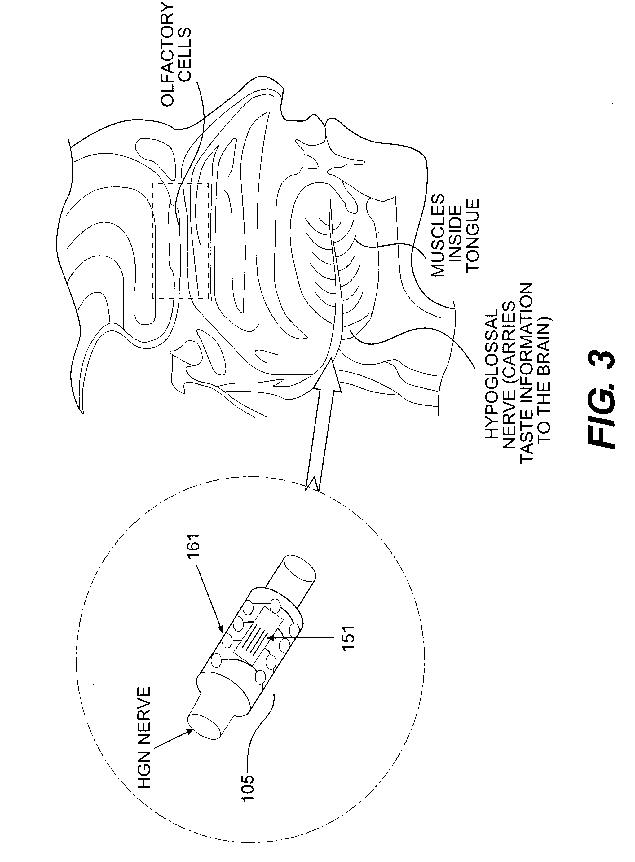 RFID-based apparatus, system, and method for therapeutic treatment of a patient