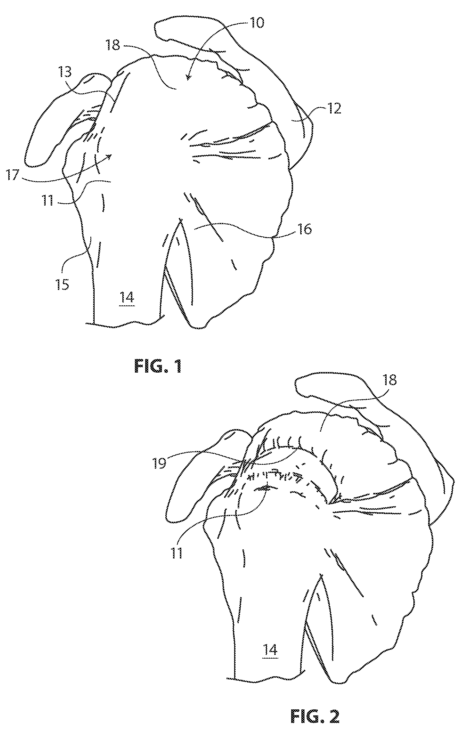 Methods and apparatus for deploying sheet-like materials