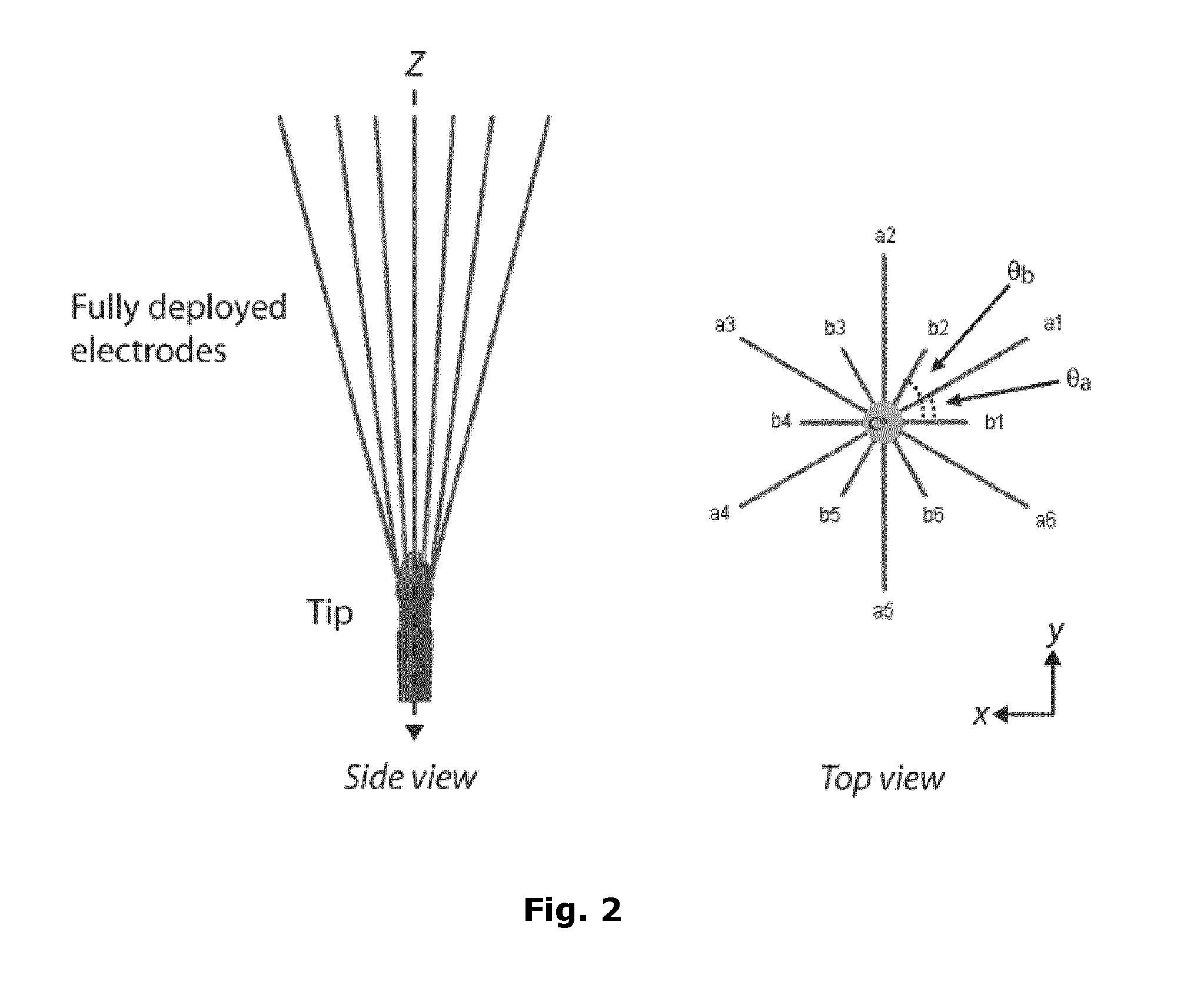 Method For Treating A Tissue Region With An Electric Field