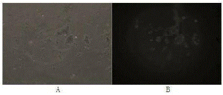 Graphene oxide-recombinant streptococcal protein A composite material as well as preparation method and application thereof