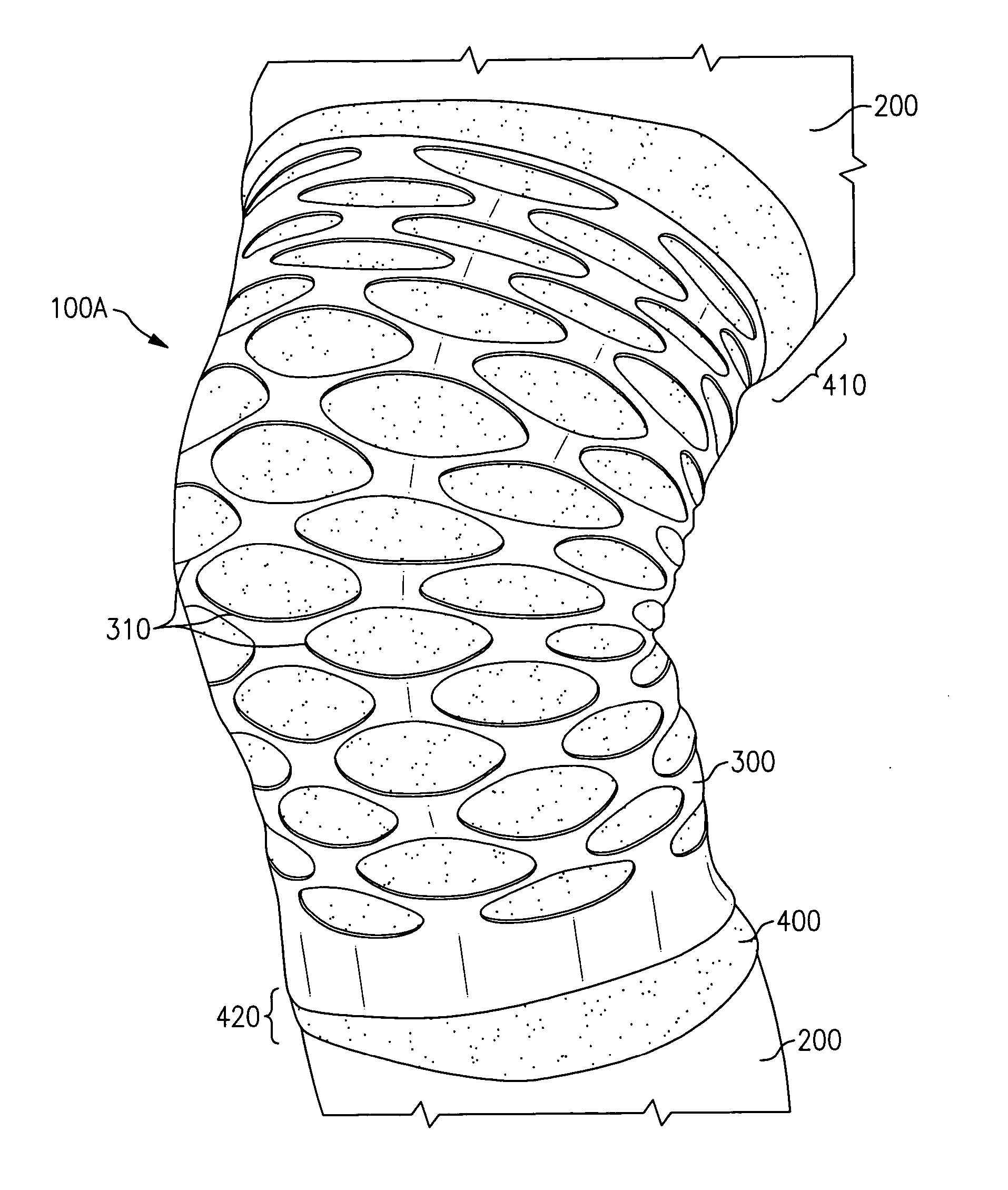 Orthopedic devices with compressive elastomer formed directly onto a base material