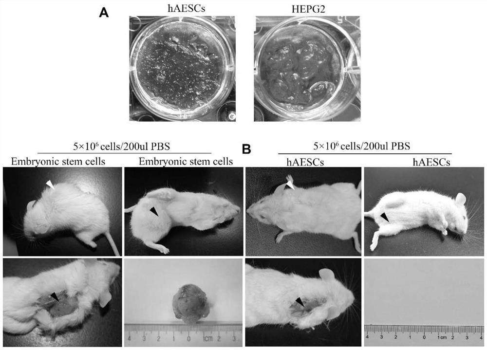 A method for inducing differentiation of amniotic epithelial stem cells into functional liver cells and its application