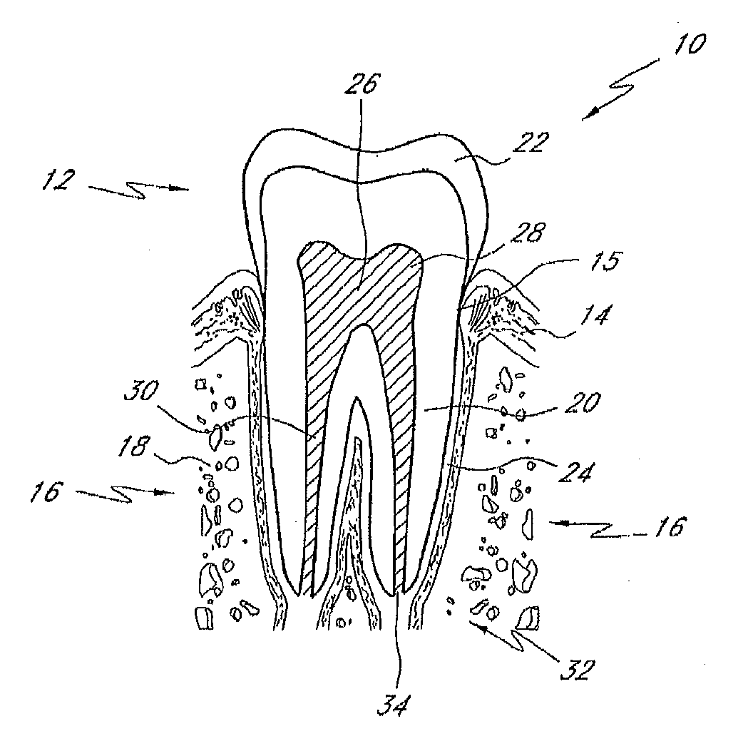 Liquid jet apparatus and methods for dental treatments